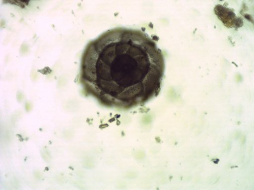 Foraminifera in dental calculus  (Thanks to A.Tavarone, Argentina)
